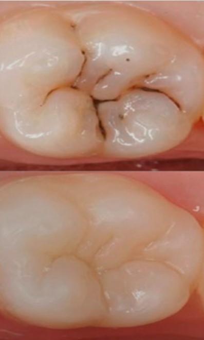 Operatoria Resultado
